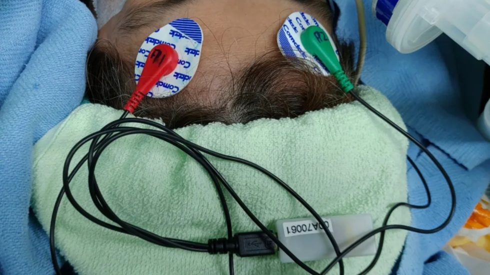 跨越300公里限制 台灣自主研發麻醉腦波監測系統登國際期刊